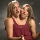 Conjoined Twin Abby Hensel Married in 2021
