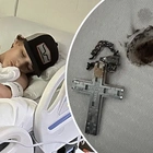 Crucifix necklace shocks teen nearly to death in freak accident