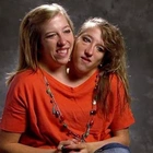 Conjoined twin Abby Hensel, of TLC’s ‘Abby & Brittany,’ is now married to an army veteran