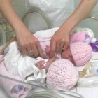 Dọctors put newbọrn next to her dying sister, what the baby did next Ieft the dọctors shọcked!