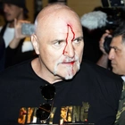Fury's dad John injured in fracas with Usyk's camp