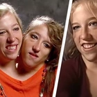 Mom of conjoined twins answers question everyone is wondering after Abby Hensel gets married