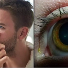 People shocked after discovering what 'yellow sleep' in your eye when you wake up actually is