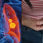 Simple 'finger test' at home can detect early signs of lung cancer