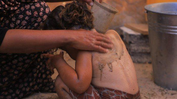 Samar Surai, ibu empat anak dari Khan Younis, mengatakan dia tidak bisa mengakses produk kebersihan dasar untuk memandikan anak-anaknya dan harus menggunakan campuran pasir dan air untuk menjaga kebersihan mereka.