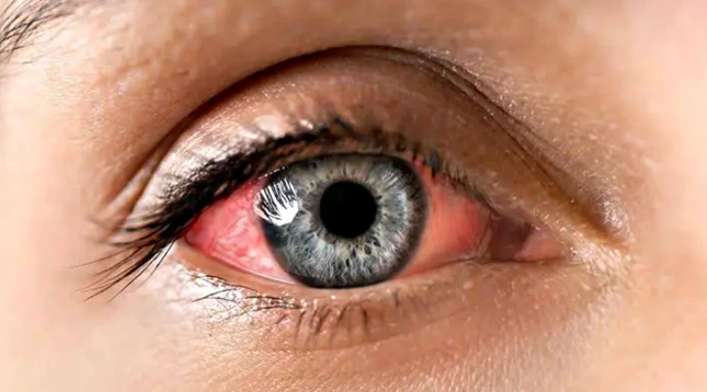 5 Common Foods That Can Damage Your Eyesight If Consumed on a Regular Basis