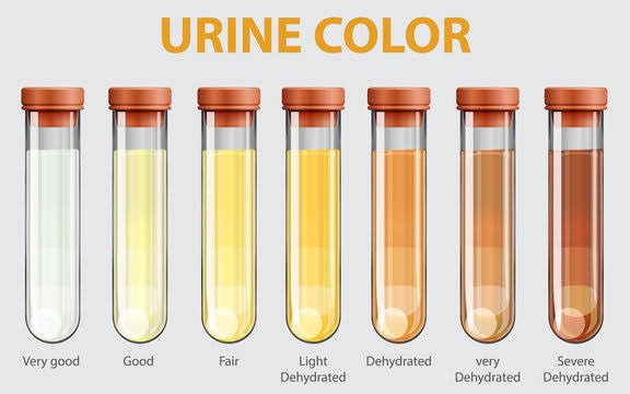 checkout-the-meaning-of-different-colours-of-urine-opera-news