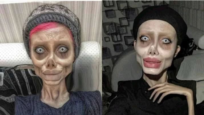 A beautiful woman turns into a zombie after undergoing surgery to change her looks. 4