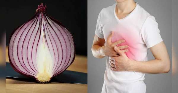 onion side effects know side effects of eating raw onion janiye pyaaz khane  ke nuksan samp | Onion Side Effects: कच्ची प्याज खाने से हो सकती है ये  बीमारी, जान लें प्याज