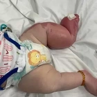 Toddler born with rare condition which causes foot to 'grow uncontrollably'