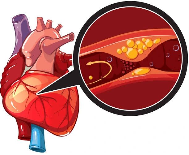 3 Signs That Indicate You Have Coronary Artery Diseases. 0d9c9e59aafe4940a4f77ba513e8fb06 quality uhq format webp resize 720