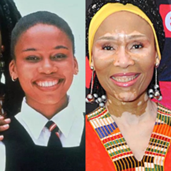 From Brown To White Skin, See What Happened To The Sarafina Actress