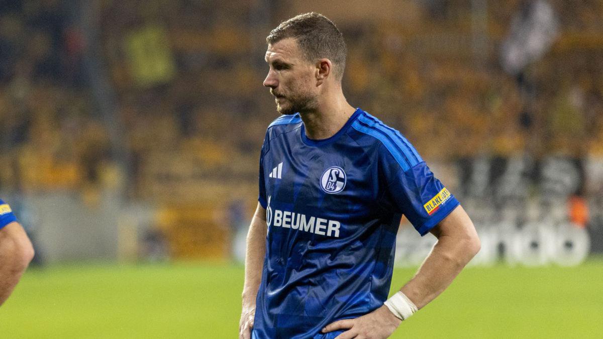 Edin Dzeko im DFB Pokal gegen Dynamo Dresden