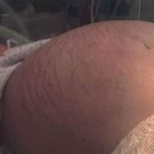 Woman carrying the weight of 7 babies in her huge beIIy, but doctors had frlghtening news!