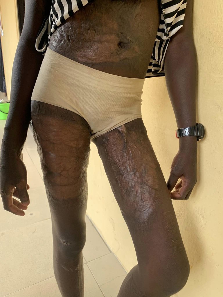 Woman subjects her 12-year-old stepdaughter to h0rrific ab*se with kn!fe, cutlass and fire for eating food without her permission (video)