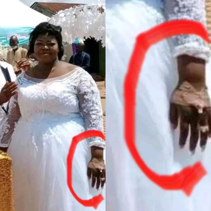 Sick Bride who was discharged from hospital to attend her wedding d!es the next day (photos) 4