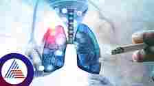 Lung Cancer: Know the Signs, causes, symptoms, and early detection RBA