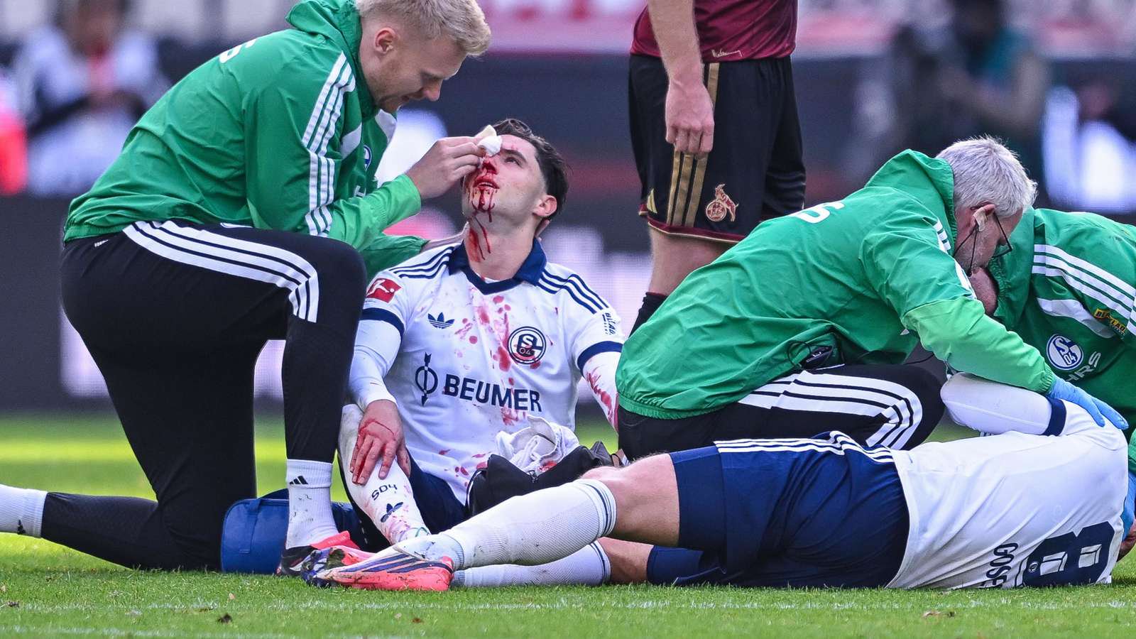 Die Schalke-Profis Soufiane El-Faouzi (l.) und Robin Gosens werden nach ihrem Zusammenstoß behandelt.