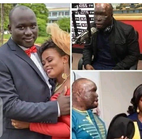 1b5cfd60187d428198f54c58b86d583e?quality=uhq&format=webp&resize=720 Ghanaian Police Officer Burnt With Acid And Electrocuted By His Wife Photos Drop -See Sad Photos