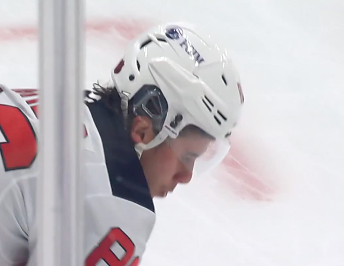 Jack Hughes lost a tooth on the ice for the second time this year