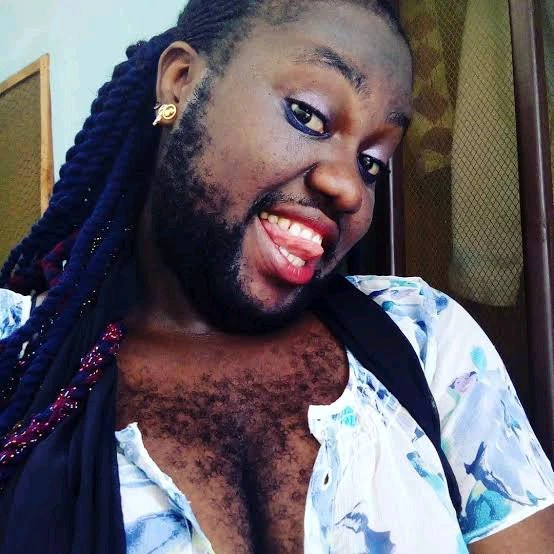Pictures of women with facial hair causes stir online (photos)