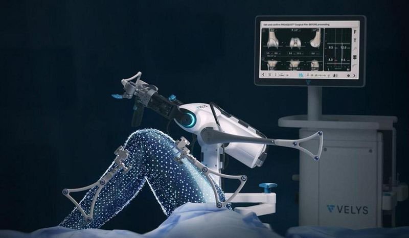 Semakin Canggih, Velys Robotic Bantu Operasi Implan Lutut Lebih Mudah dan Akurat