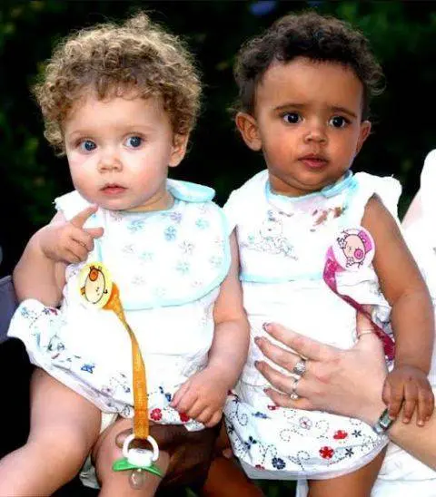Wonderful This Twin Sisters Were Born With Totally Different Looks (Photos)