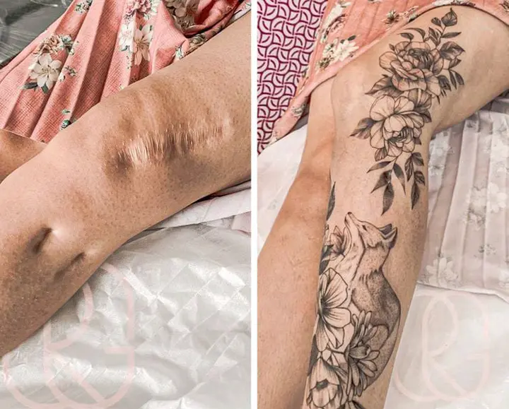 Transformation Twenty-Two Scars Into Beatify Tattoos