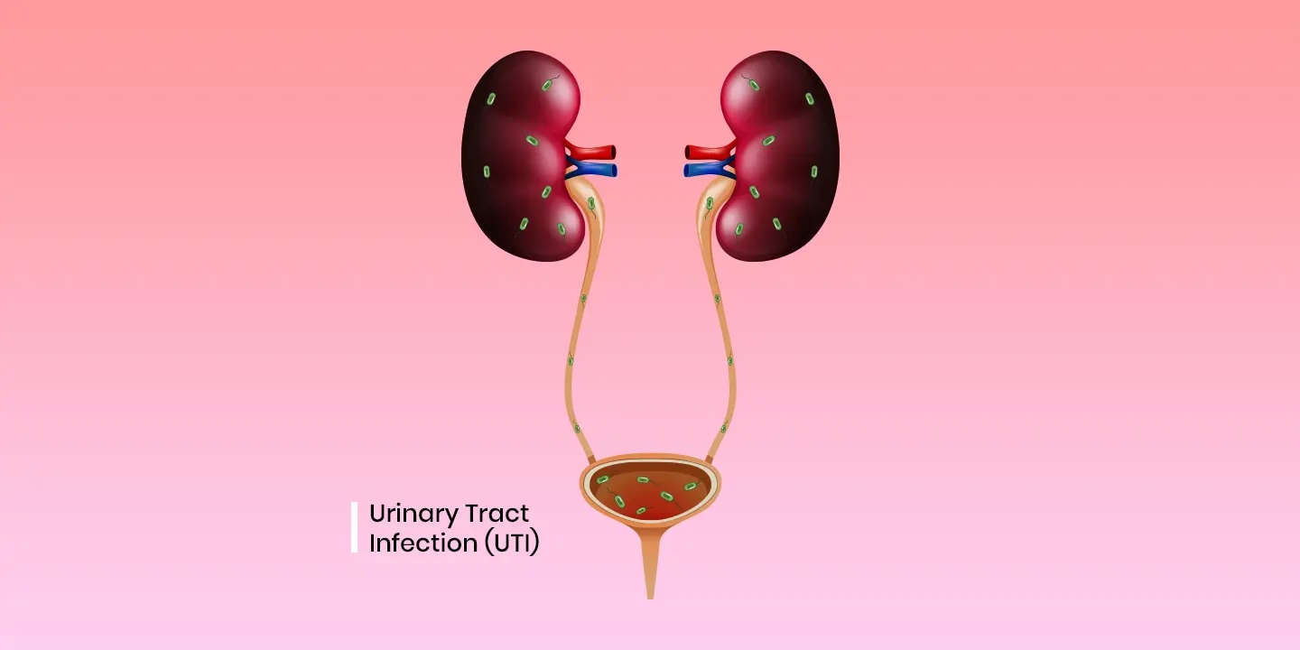 Urinary Tract Infection (UTI): Symptoms, Causes, and Treatment In India