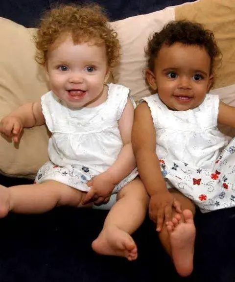 Wonderful This Twin Sisters Were Born With Totally Different Looks (Photos)