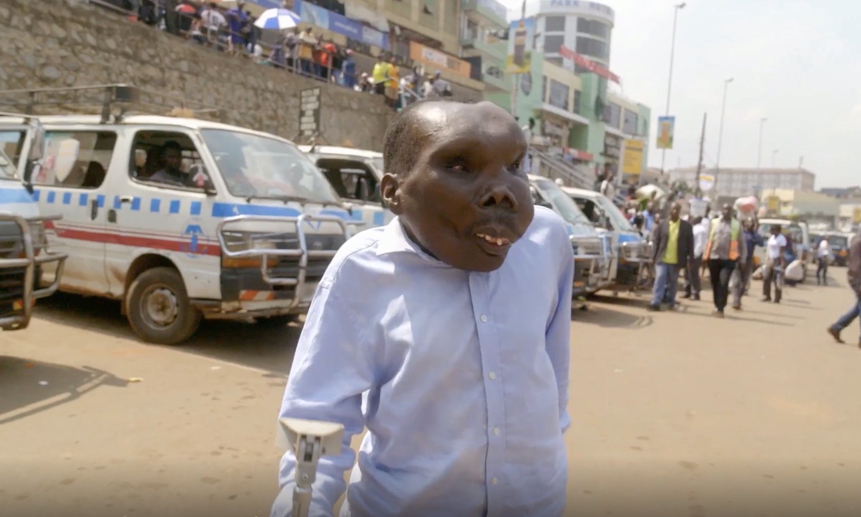 Godfrey Baguma from Uganda standing with a crutch in a busy city street.