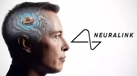 Neuralink.
