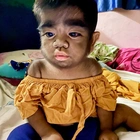 Mother feared her son's 'werewolf syndrome' condition was caused by eating a CAT to satisfy her cravings while she was pregnant