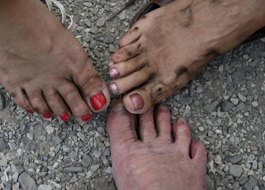 Tip-top toes: Zimbabwean government slams toe-selling craze [photos]