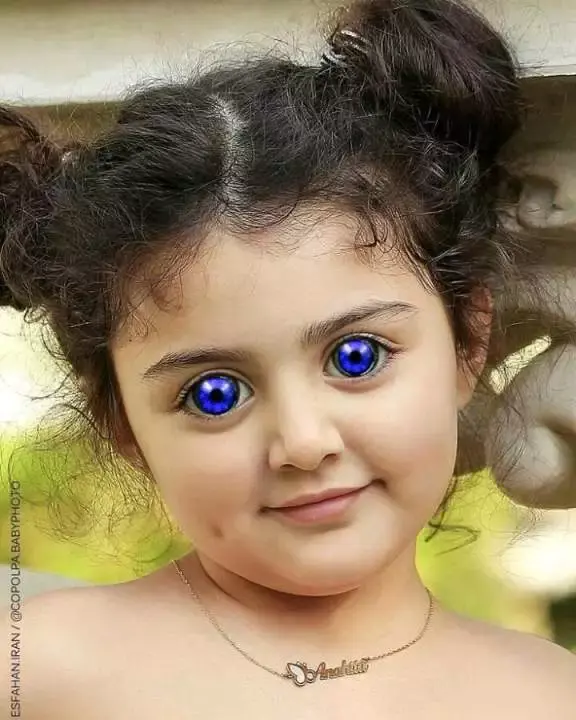 Wonderful! Photos Little Kids That Were Born With Strange Eyes