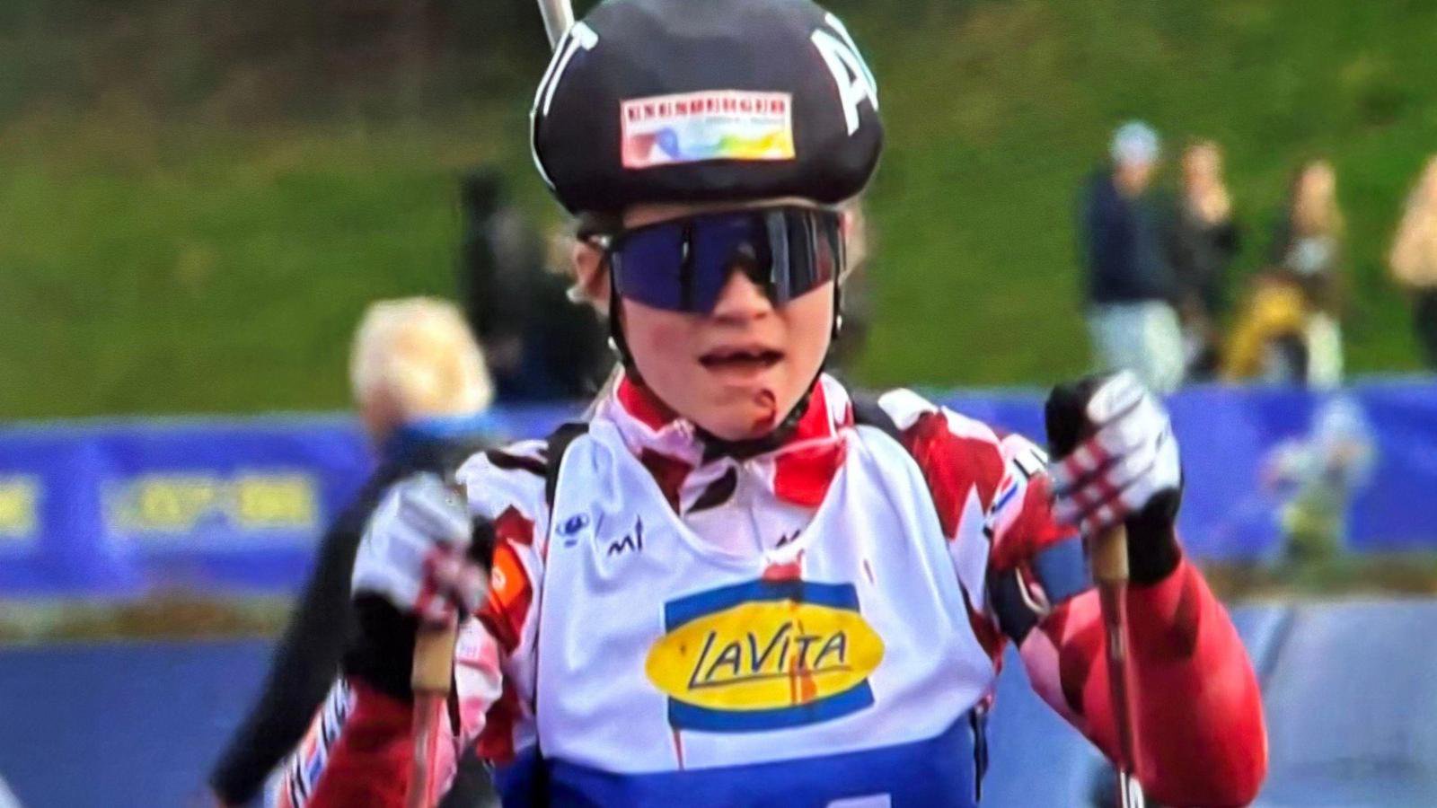 Biathletin Lara Wagner verlor zwei Zähne in München.