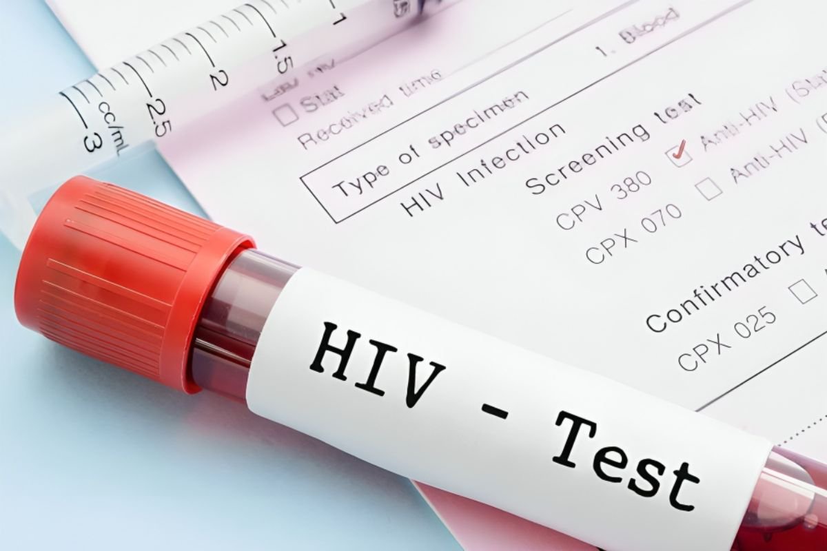 HIV-TEST