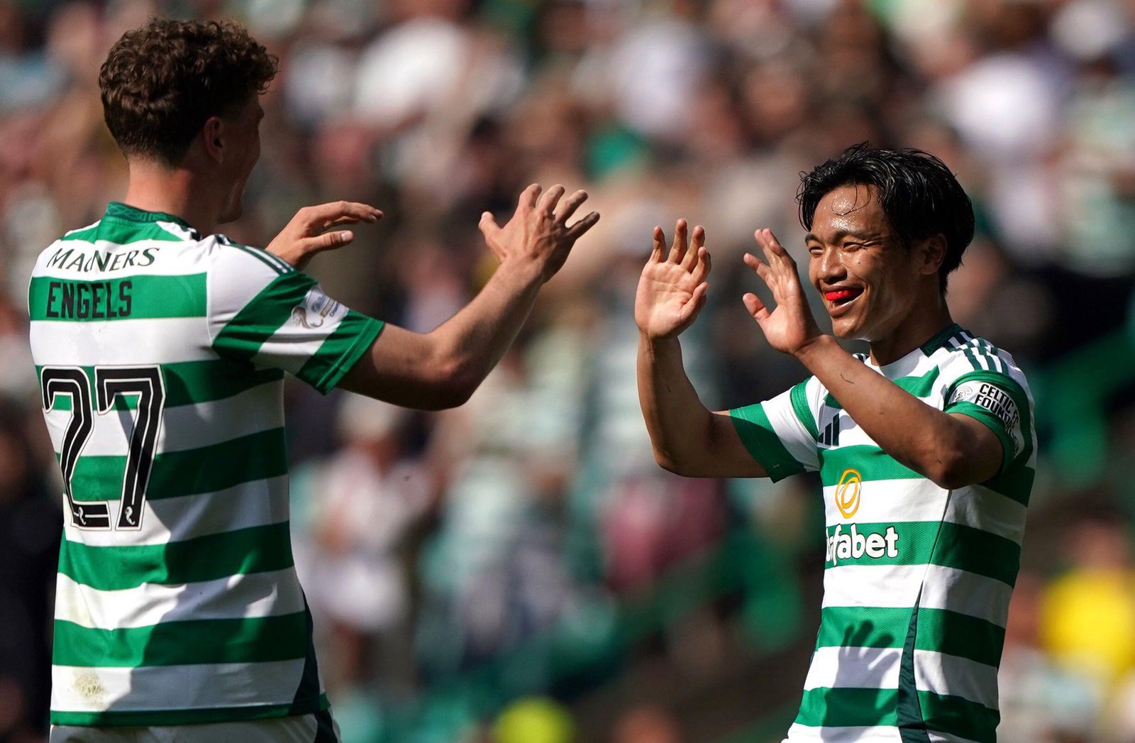 Celtic Loanee Addresses Future Amid £3m Permanent Move Talk