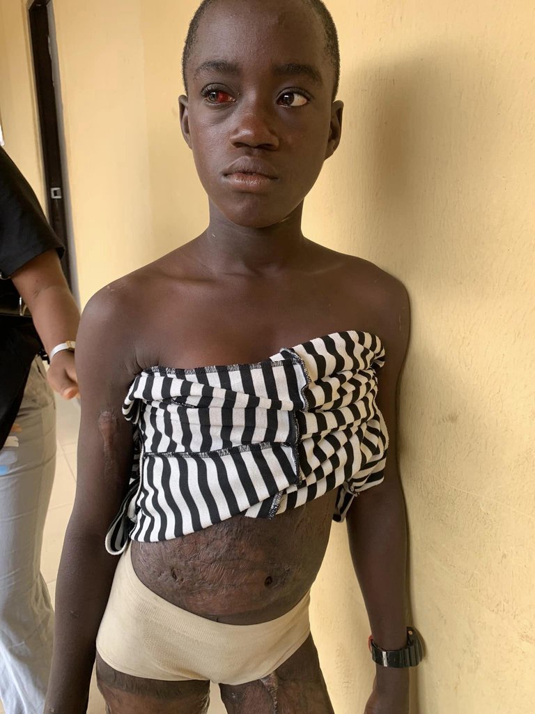 Woman subjects her 12-year-old stepdaughter to h0rrific ab*se with kn!fe, cutlass and fire for eating food without her permission (video)