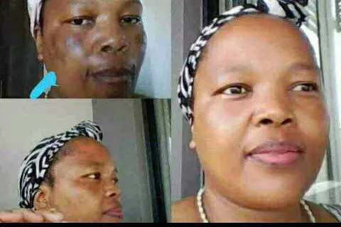 When your face has dark spots, use these for smooth spotless skin