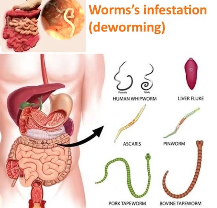 Parasite Cleanse 3 Healthy Ways To Deworm Your Body To Prevent Illness Jasperchi Com