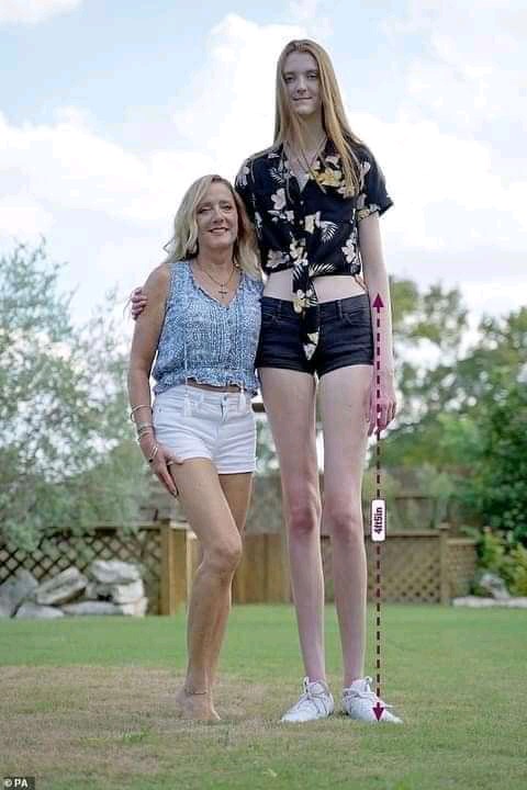 La Femme Avec Les Plus Grandes Jambes Du Monde A 17 ans elle détient le record de l'adolescente ayant les plus longues