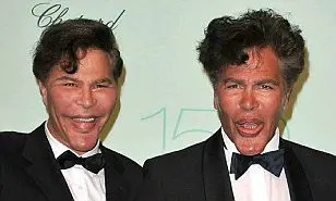 These Twin Brothers Changed Their Faces With Plastic Surgery, They Looked Before (See Photos)