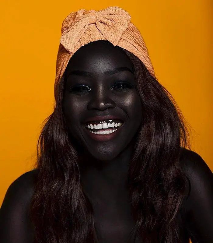 Black is beautiful: See more photos of Nyakim, the darkest girl in the world