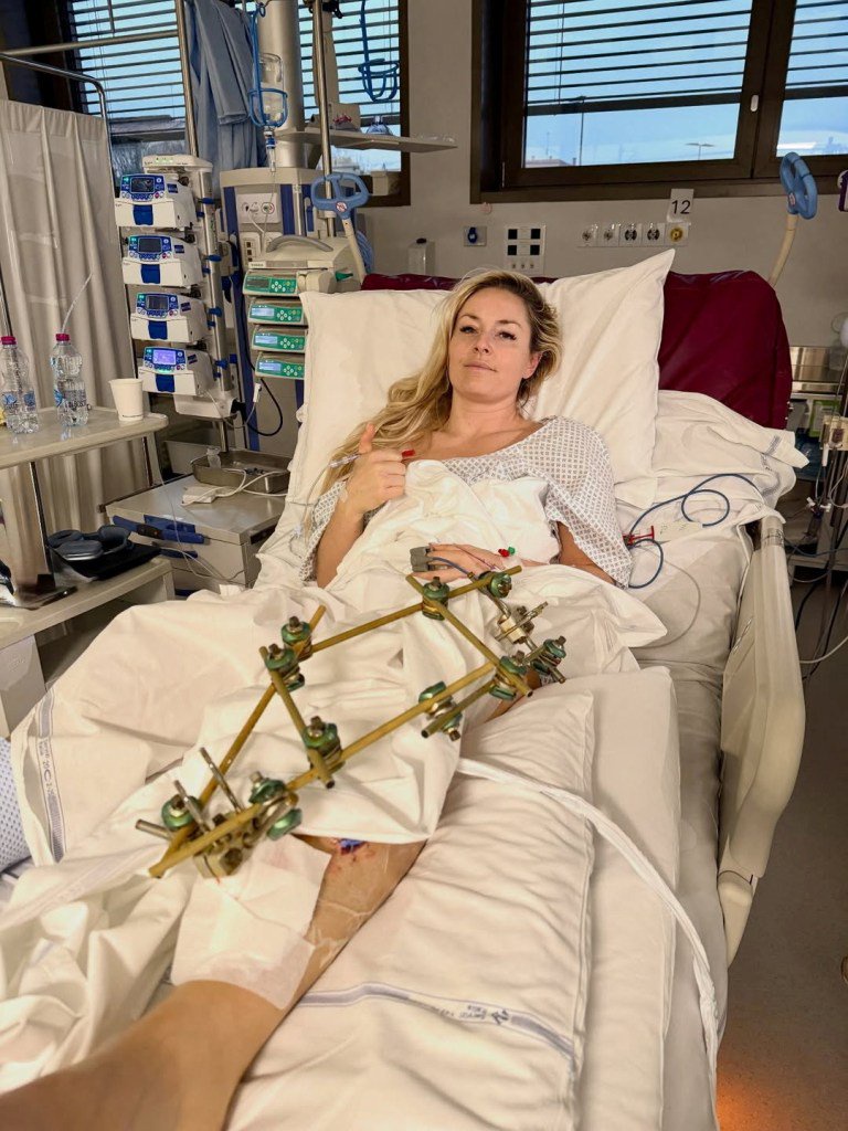 U.S. skier Lindsey Vonn lies in a hospital bed, after she crashed during the Women's Downhill, in Treviso