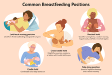 Five nursing parents in different breastfeeding positions