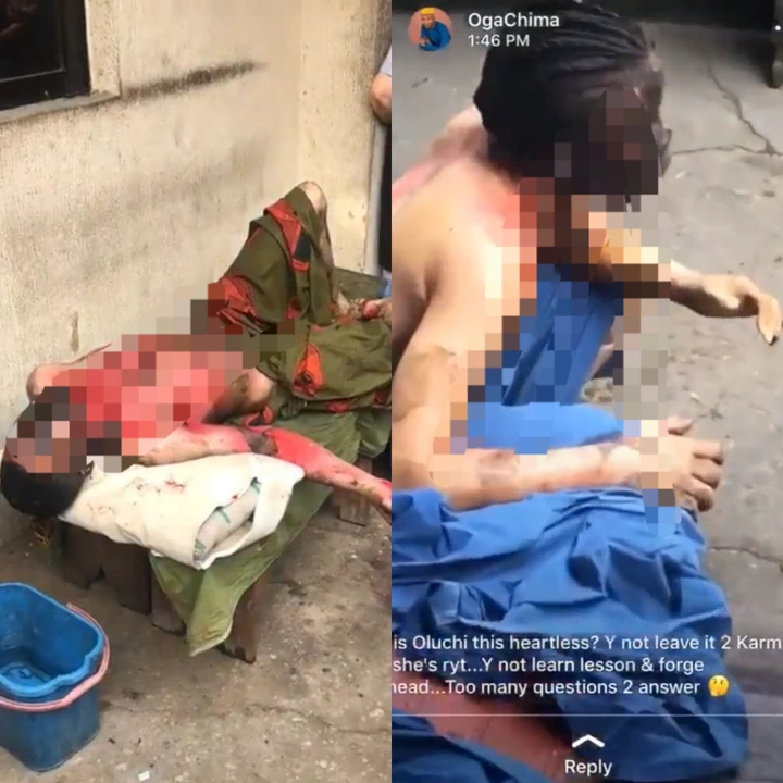 Woman sets her ex-boyfriend on fire in Abia state after discovering he was about marrying another woman after dumping her (Graphic photos/videos)