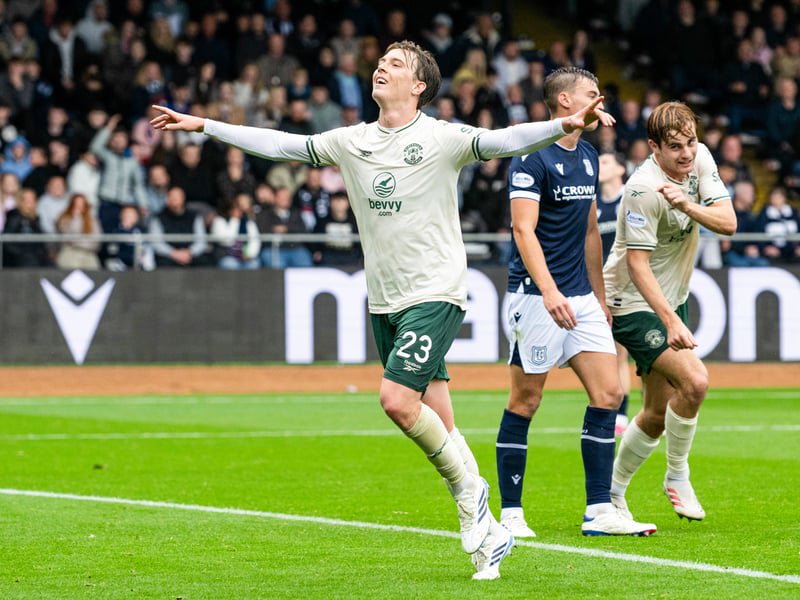 Hibs boss Marink Reedijk confirmed that the midfielder will miss the next few weeks after suffering an injury in training.