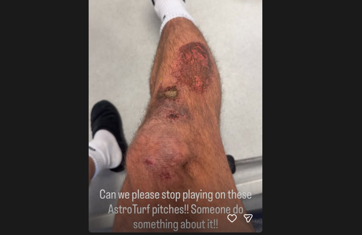 Louis Rees-Zammit has shared pictures off the injuries he suffered at Saracens