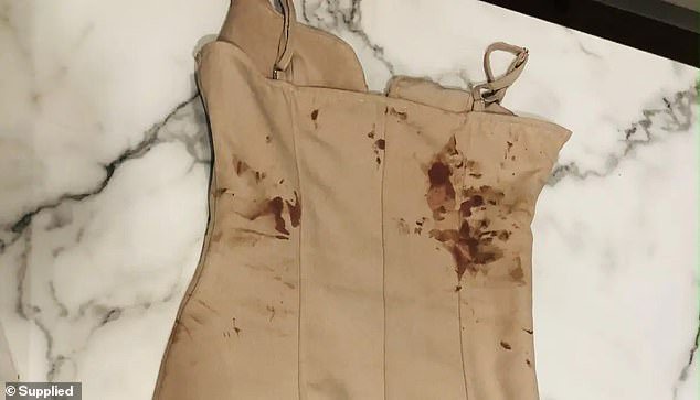 Ms Lewis' dress after she was attacked by A'Vard in February 2022
